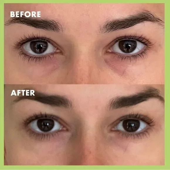 FREE💝 KOPARI Niacinamide & Caffeine Eye Bright Cream 👁️ NEW - Picture 4 of 6